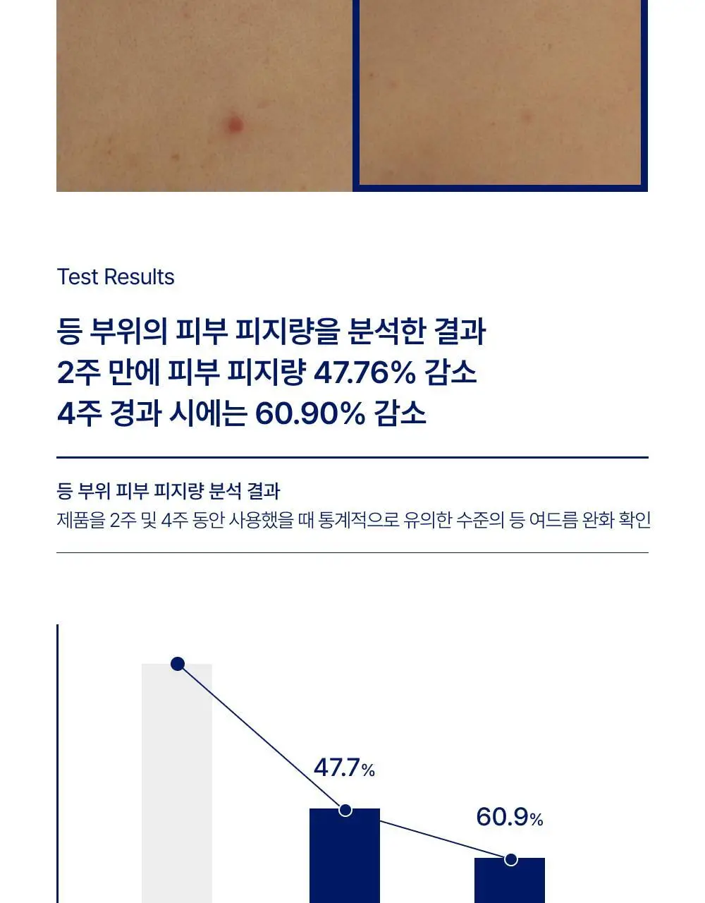 [대용량] 바이오가 등드름 바디워시 베타인살리실레이트 1000ml 기획(+바디미스트 20ml) 상세페이지 13